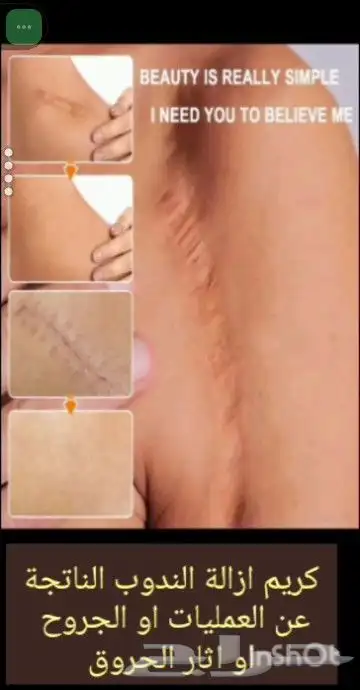 عرض العناية الصحية 9 منتجات بسعر الجملة 7