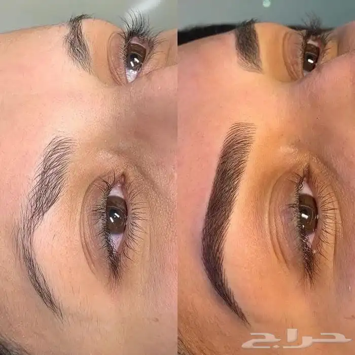ميكروبليدنج الحواجب وفرد الشعر وتنظيف البشره الطبي 5