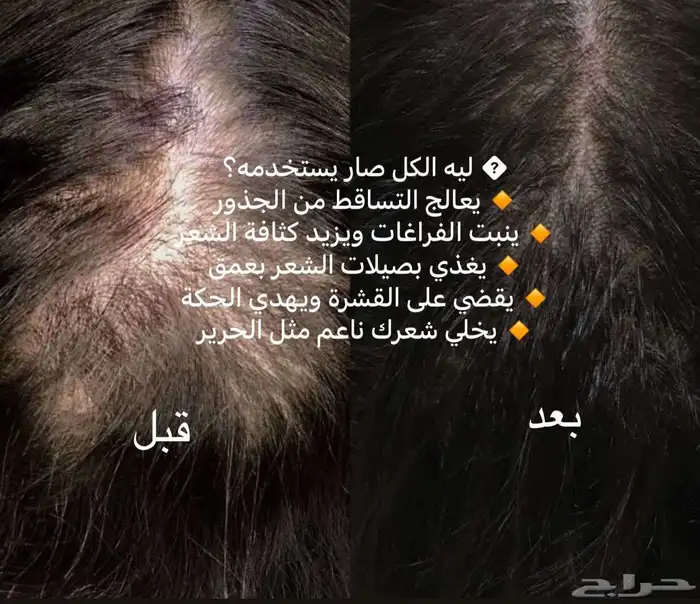 زيت تطويل الشعر 0