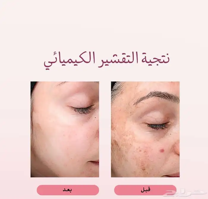 جلسات نضارة البشرة 1