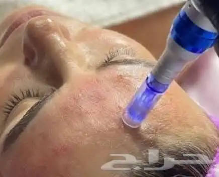 جلسات نضارة البشرة 5