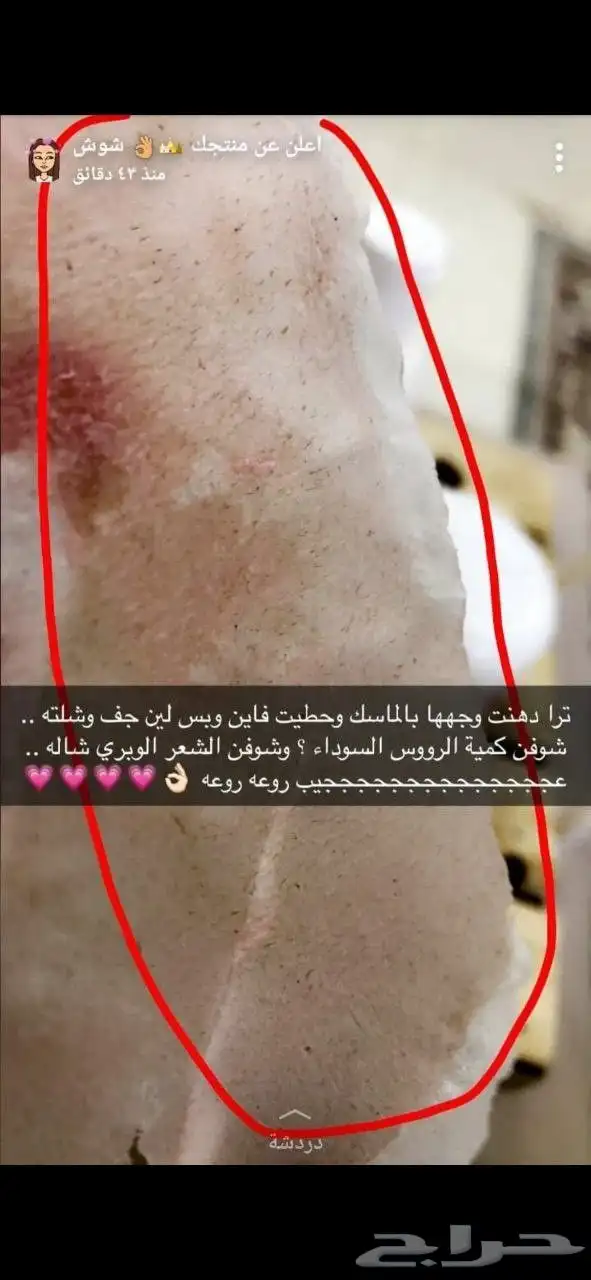 منتج بديل البوتكس للتواصل واتس 2