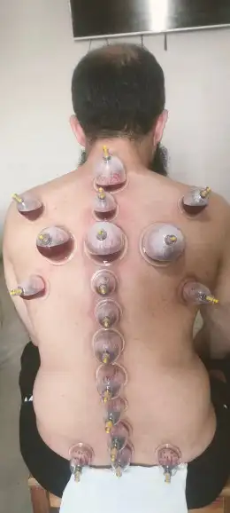 ابو عبدالله الخوارزمي للحجامة والمساج 2