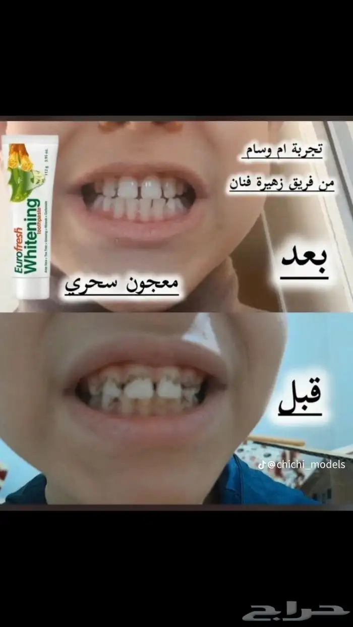 معجون الاسنان التركي بالسواك والالوفيرا .. 4