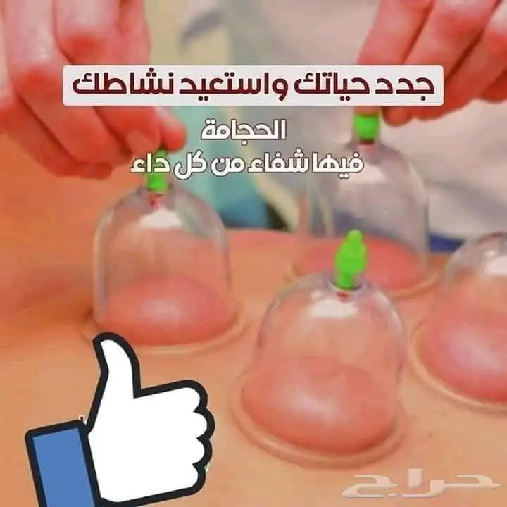 حجام مصري متخصص في عمل الحجامة 1