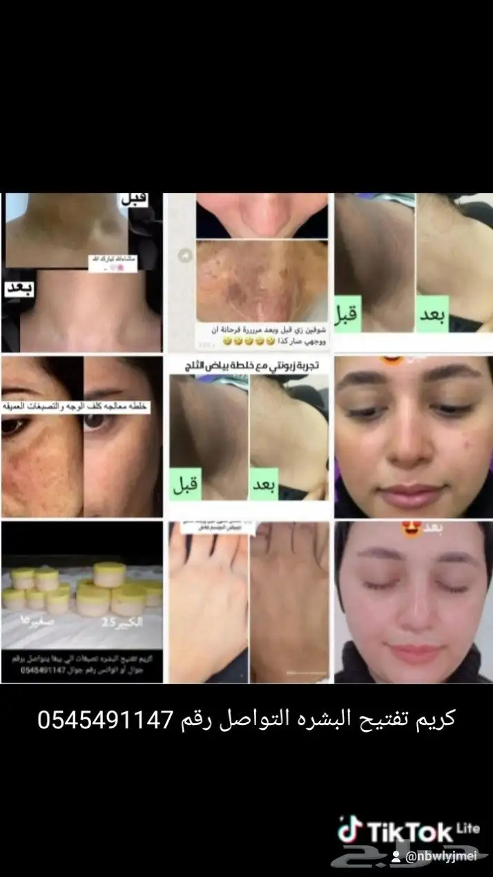 كريم تفتيح البشره تصبغات اثرات حبوب هالات سوداء 0