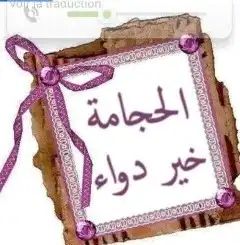 حجامه السنه لشهر محرم 2