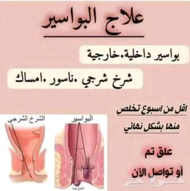 اقوي كريم دهان فعال للقضاء على البواسير والشق 0