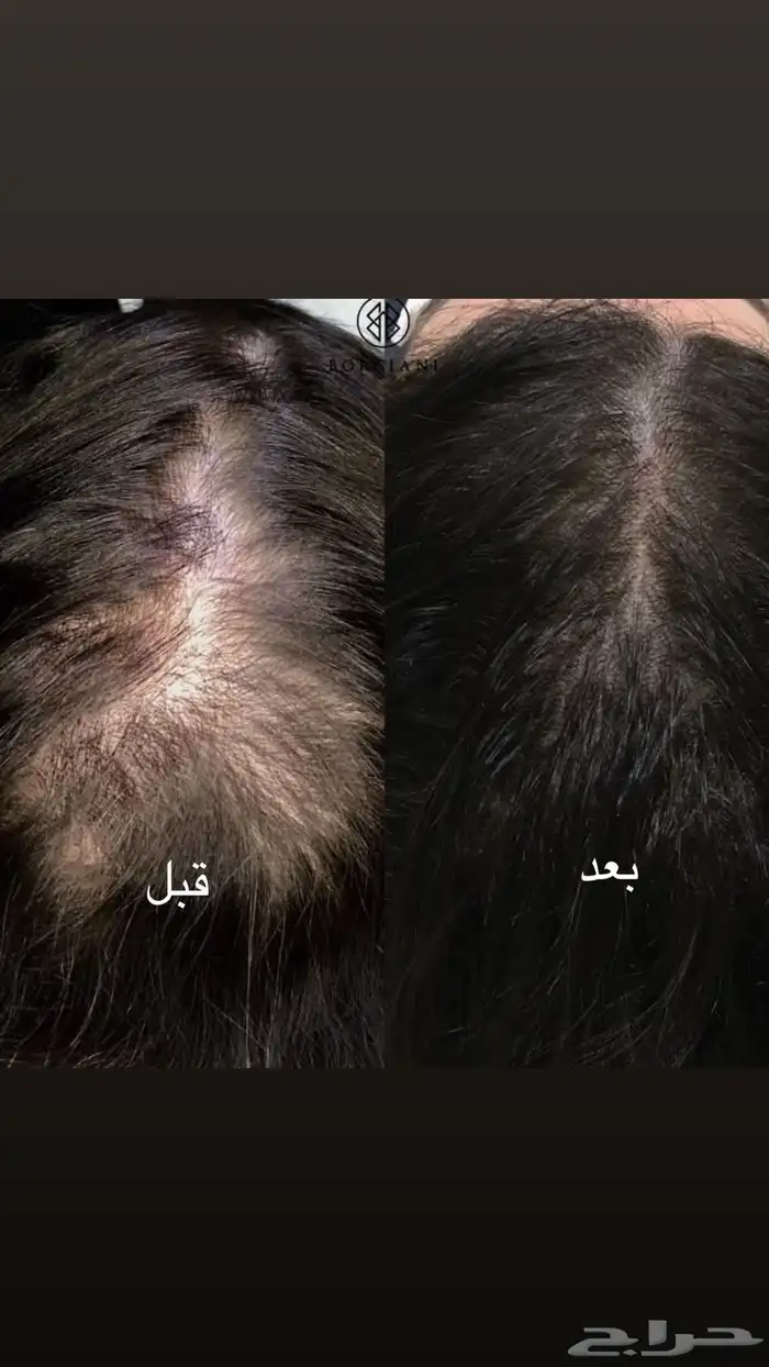 زيت الحشيش الأفغاني الأصلي 0