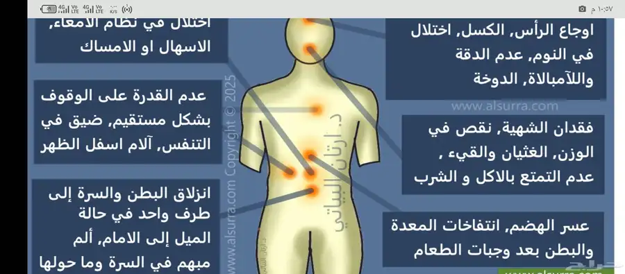 شلعة السرة 0