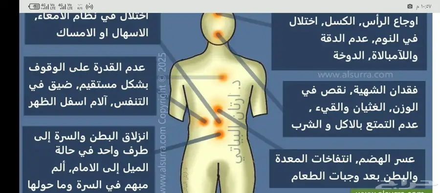 علاج شلعة السرة 1