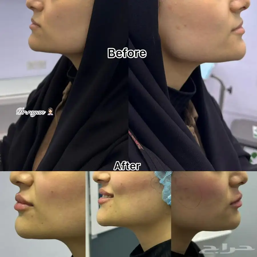 مجمع رند الثالث الطبي بالقطيف للحجز واتس 10
