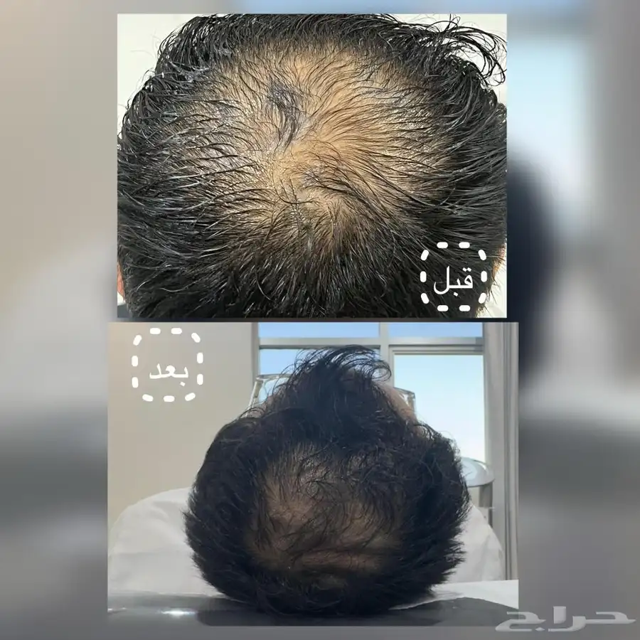 مجمع رند الثالث الطبي بالقطيف للحجز واتس 8