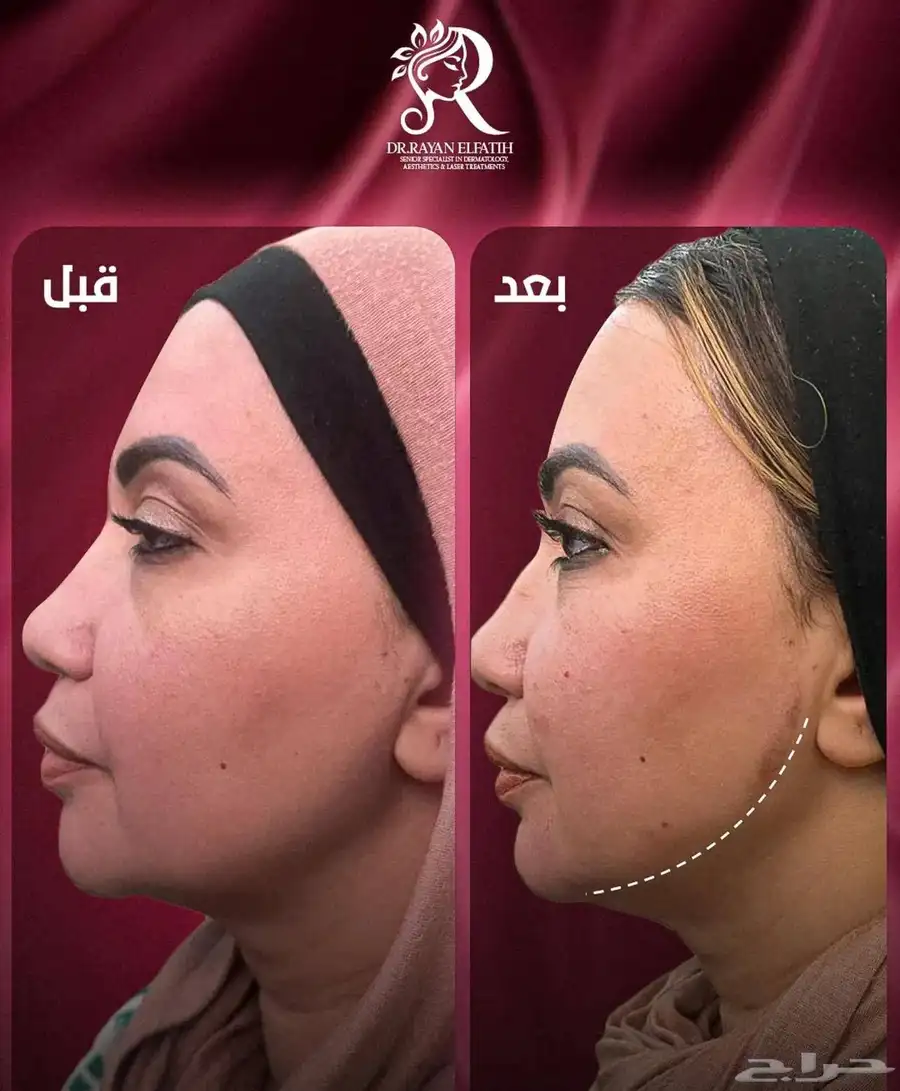 مجمع رند الثالث الطبي بالقطيف للحجز واتس 6