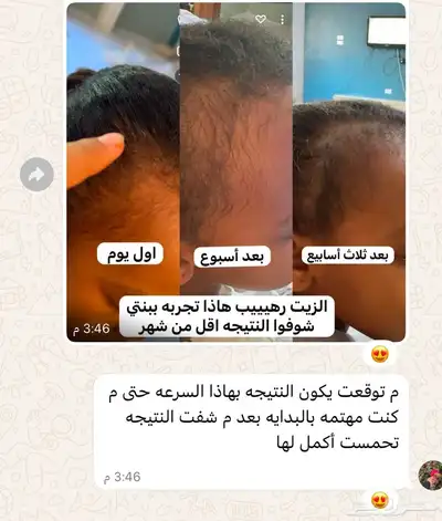 زيت الأعشاب الهنديه 1