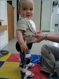 مختص علاج طبيعي للأطفال بالجمش 0