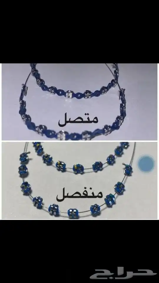 تقويم الأسنان زينه 0