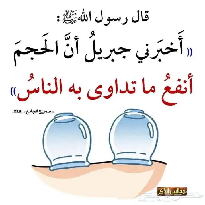 حجامه وعلاج للخلعه 0