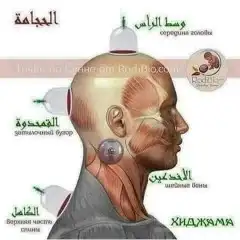حجامه وسط الرأس 0