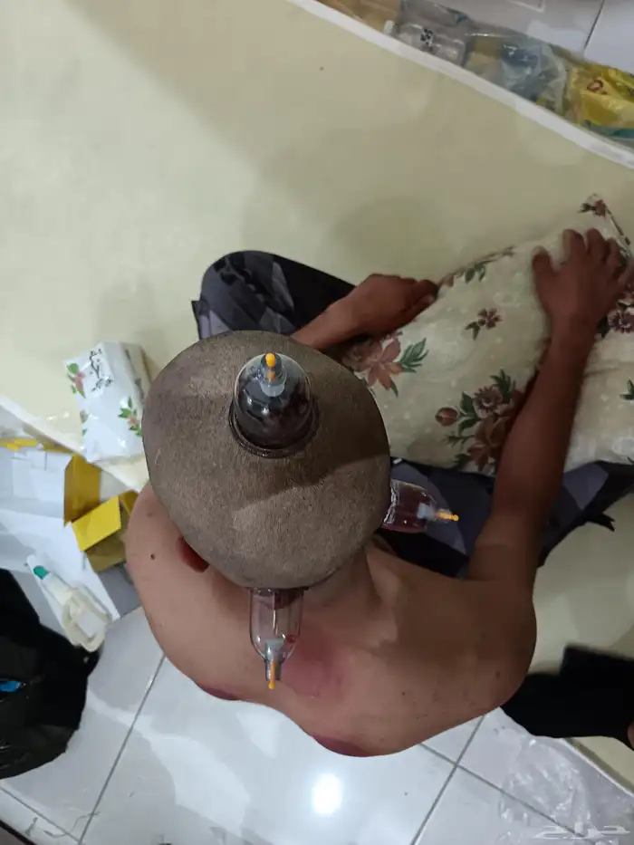 متخصص حجامة منزلية خبرة اكثر من 5 أعوام 7