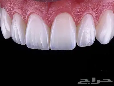 كتابة ملخصات   حل اختبارات   تصميم برزنتيشن  في طب الأسنان 0