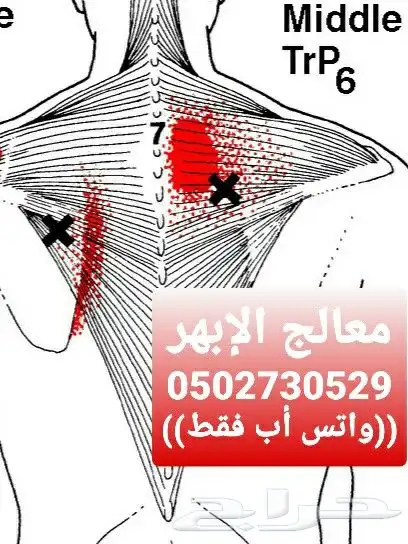 معك الأبهر أو تعرف أحد عنده ابهر علاج طبيعي وانسى الألم 0