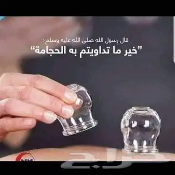 انواع السموم التي تزيلها الحجامه 1