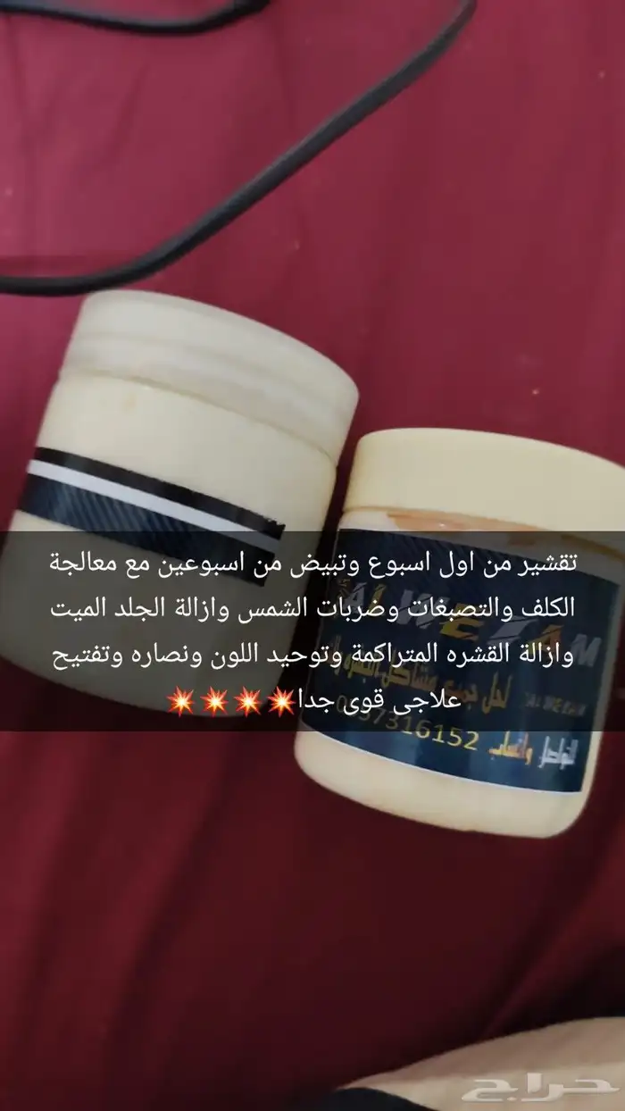 تقشير ومعالجة كلف 0