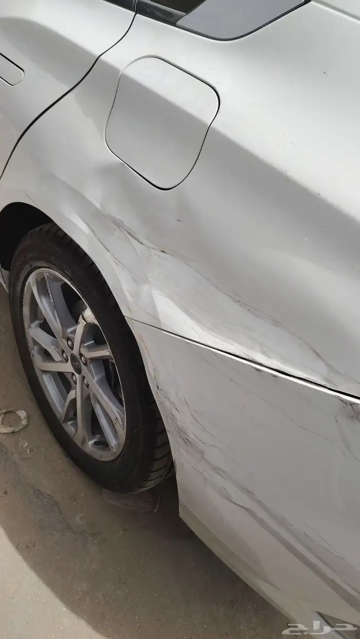 شفط بدون بوية 0