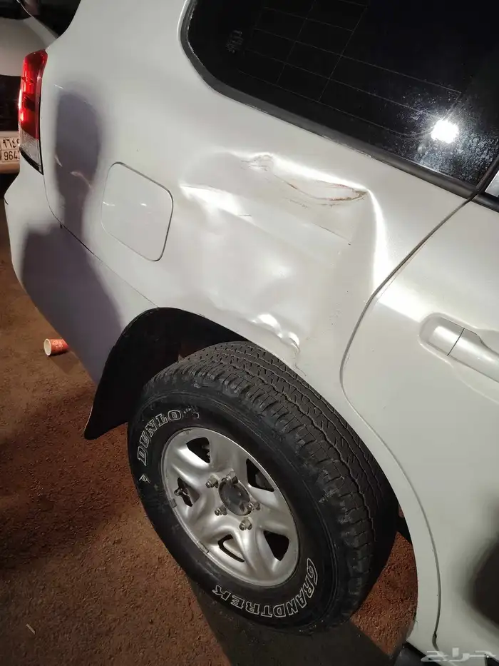 شفط بدون بوية 1