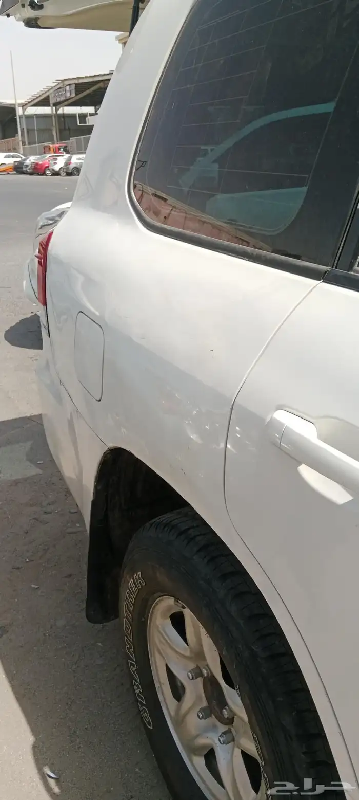 شفط بدون بوية 4