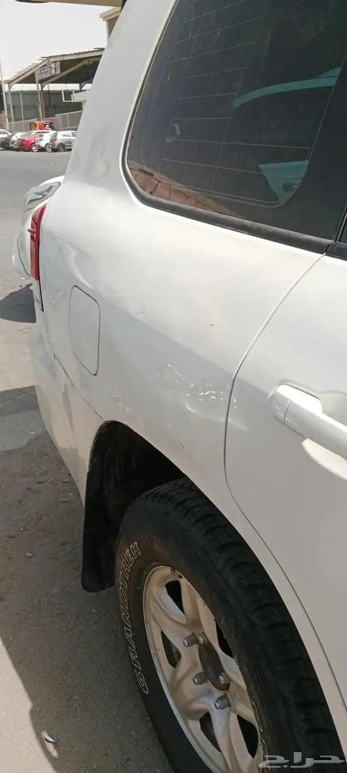 شفط بدون بوية 3