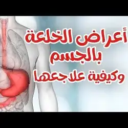 الخلعه وعلاجها 0