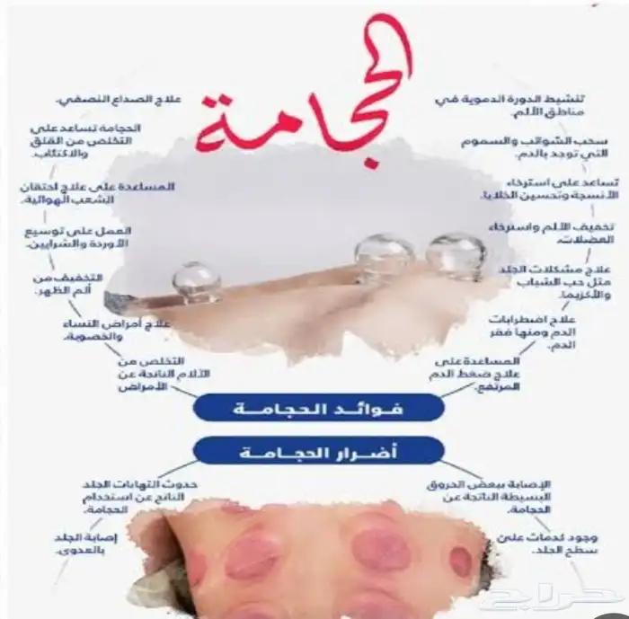 متخصص حجامة 0