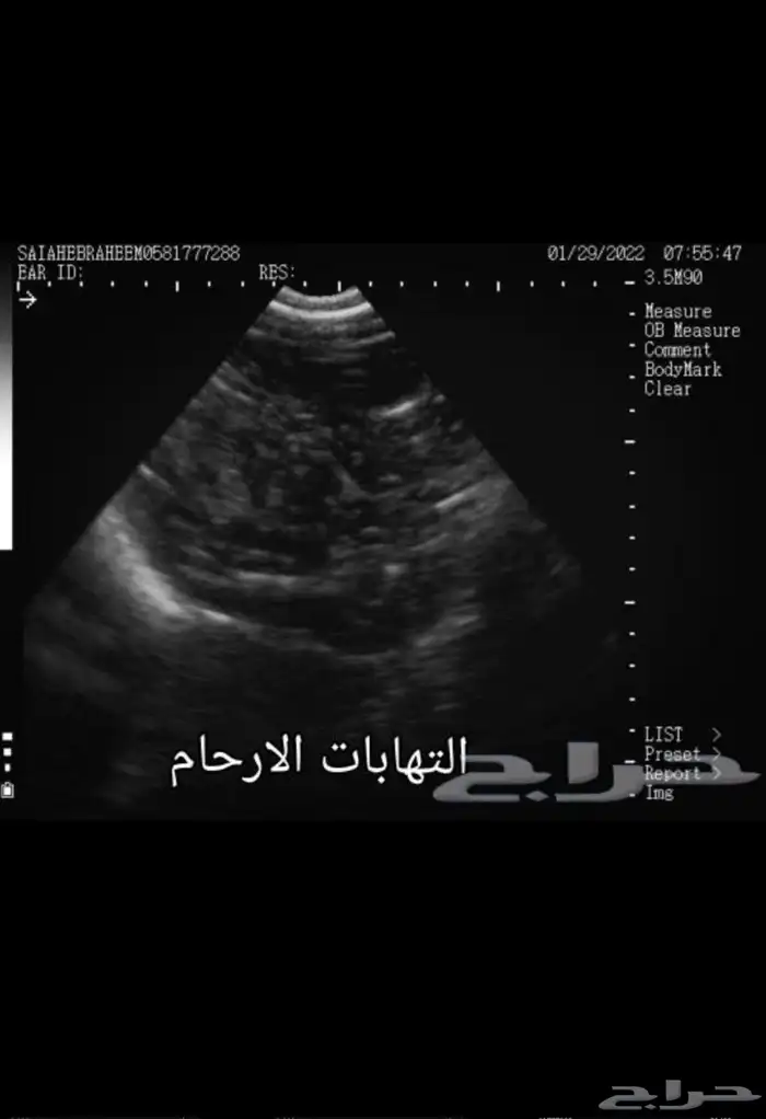 كشف سونار اغنام 1