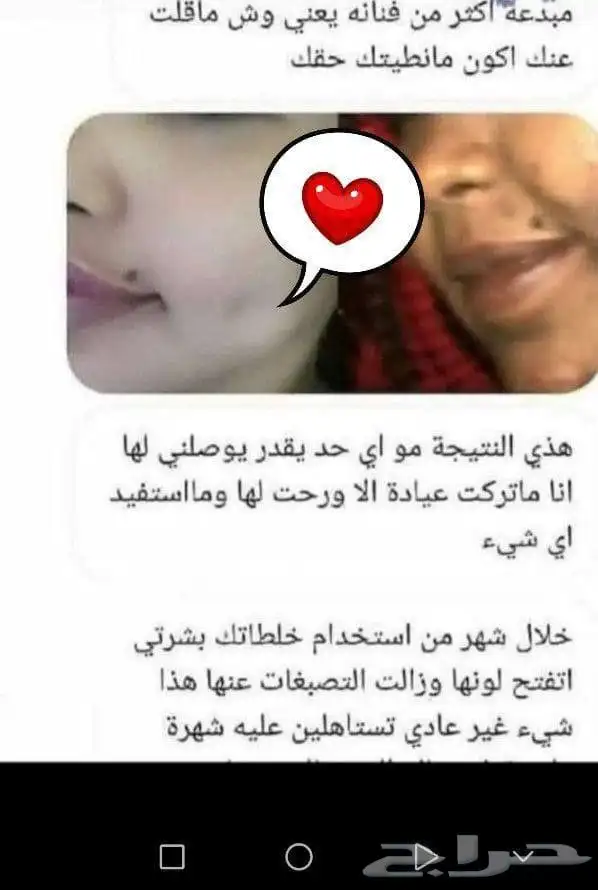 الخلطه الملكيه سنو وايت لتبييض الوجهه والجسم 1