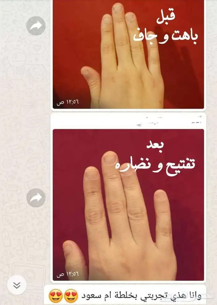 الخلطه الملكيه سنو وايت لتبييض الوجهه والجسم 9