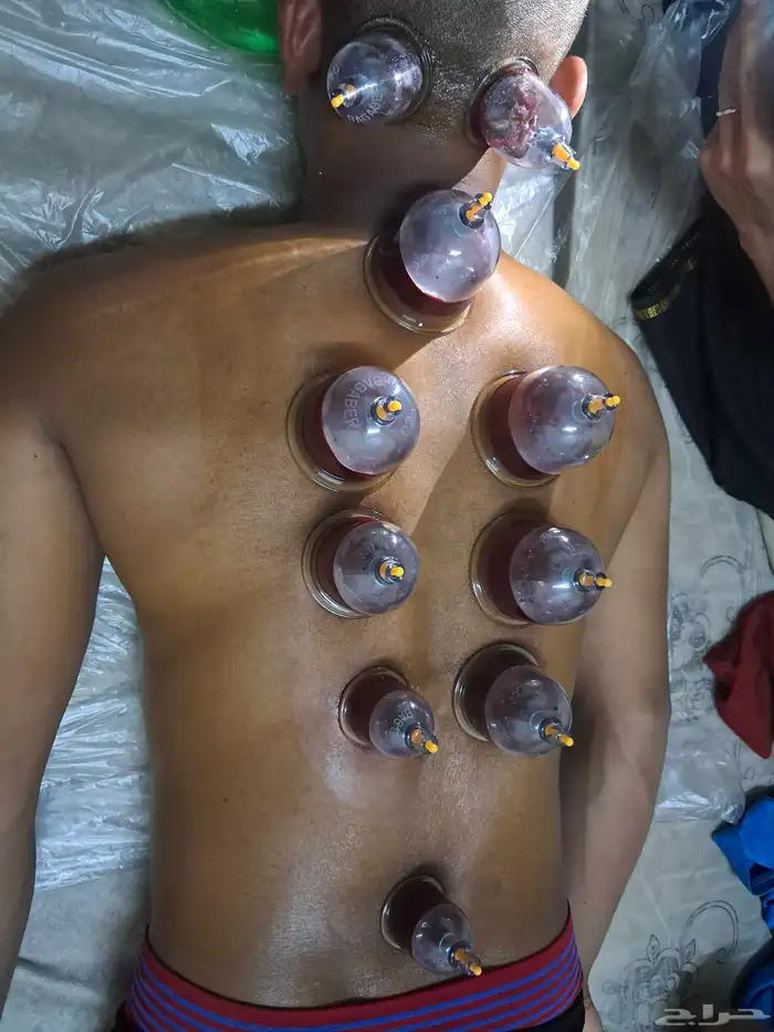 اخصائي حجامه منزليه 0