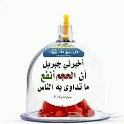 متخصص حجامة منزلية خبرة اكثر من 5 سنوات 0