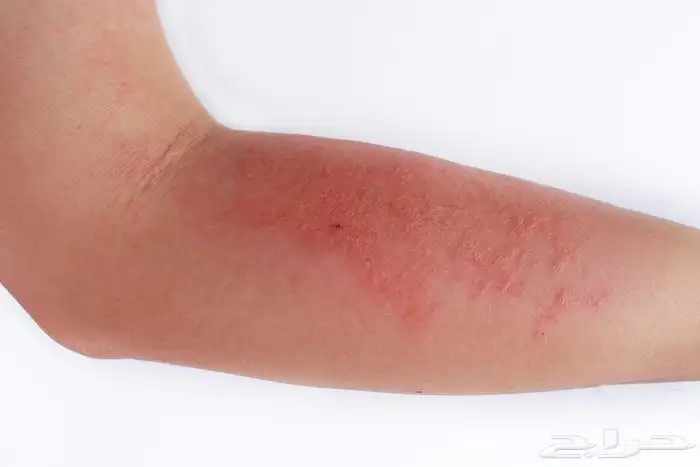 عروض اليوم الوطني مستمرة  لا تفوت فرصة الراحة والجمال 2