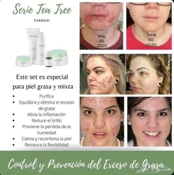 مجموعة علاج حب الشباب والحبوب الهرمونية.. طبية تركية 4