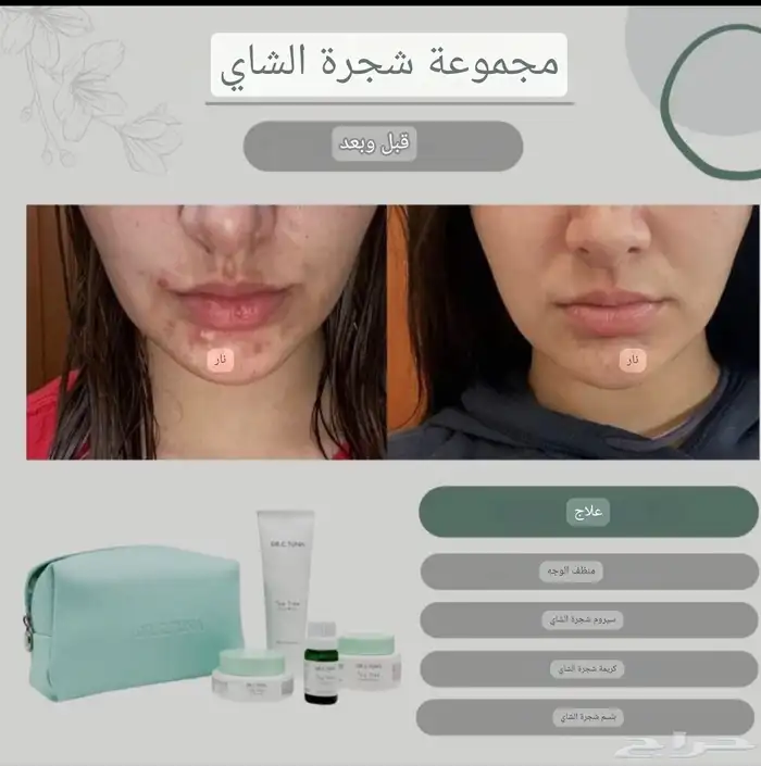 مجموعة علاج حب الشباب والحبوب الهرمونية.. طبية تركية 3