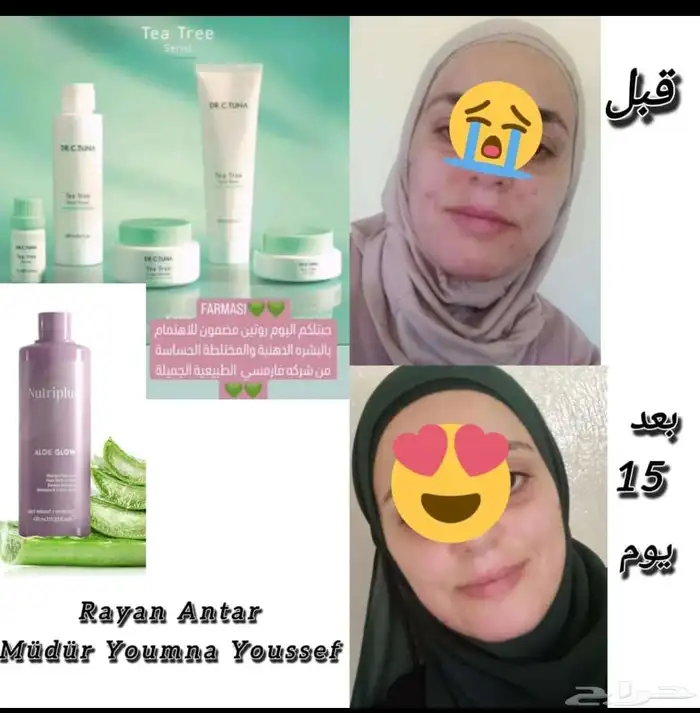 مجموعة علاج حب الشباب والحبوب الهرمونية.. طبية تركية 5