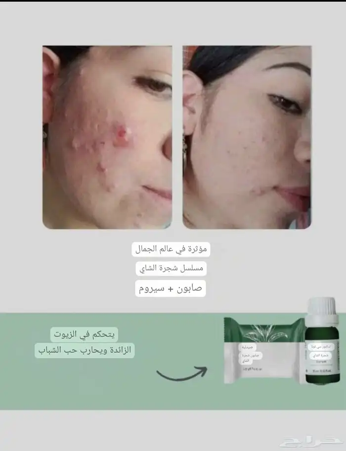 مجموعة علاج حب الشباب والحبوب الهرمونية.. طبية تركية 1