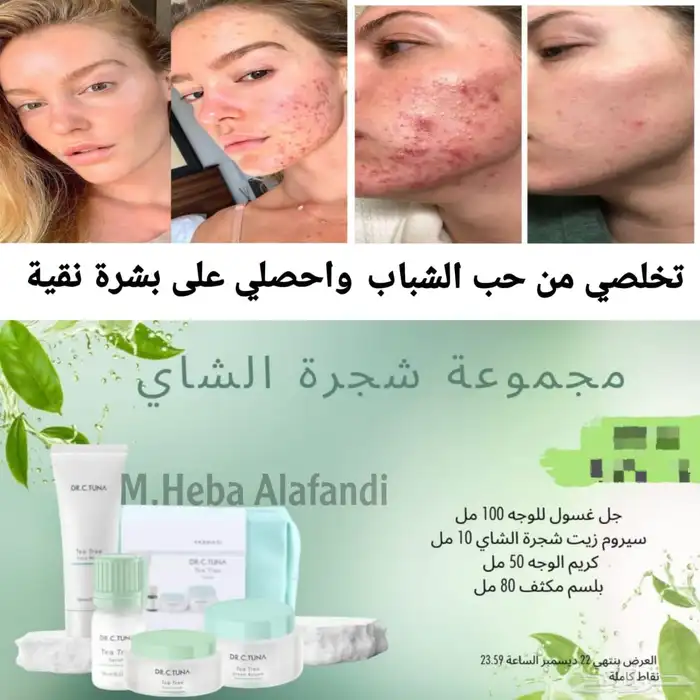 مجموعة علاج حب الشباب والحبوب الهرمونية.. طبية تركية 6